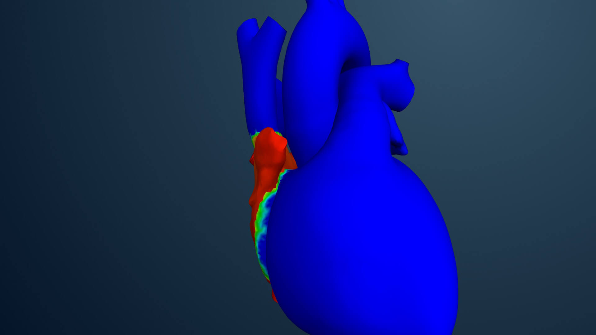 Sim_Heart_1